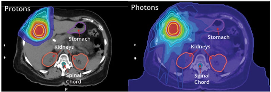 protons vs photons
