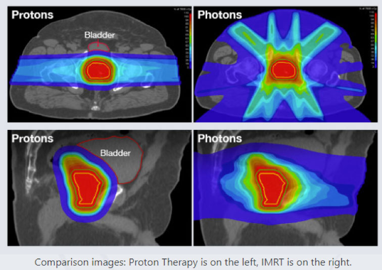 proton vs photon radiation